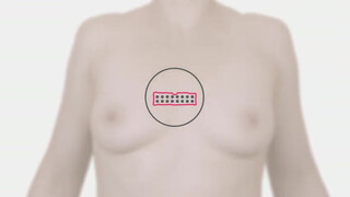 4. Another breast exam