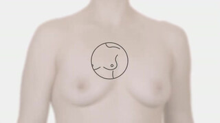 3. Another breast exam