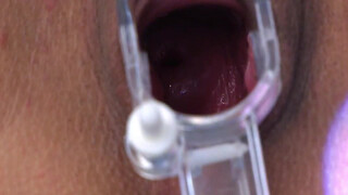 9. Another video that suggests that one needs to be fully nude to get a gynecological exam!