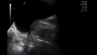 8. Brief penis shot at 1:31 before penetration is caught on ultrasound machine in “#LOVERS’SGUIDE /sex education.Poradnik kochanków”