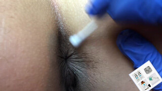 10. Nice procedure.