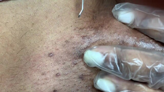 5. First time I’ve seen a blackhead removal video from the pussy, “Vajacial (EXTRACTIONS) Hygiene Routine”
