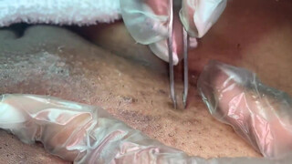 9. First time I’ve seen a blackhead removal video from the pussy, “Vajacial (EXTRACTIONS) Hygiene Routine”