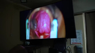 9. Dr Porno at it again with “Female sexual response and changes in the body 2 months after hysterectomy”