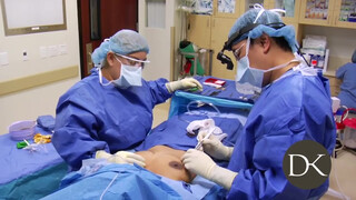 5. Stay At Home Mom Gets Huge Implants 0:52, 4:02