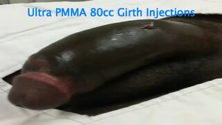 2. Penis enlargement surgery with Huge one at 2:57