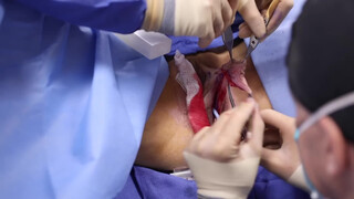 4. Pussy Op- acceptable because it’s medical?