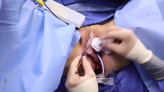 5. Pussy Op- acceptable because it’s medical?