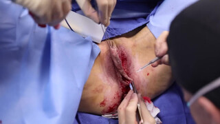 6. Pussy Op- acceptable because it’s medical?