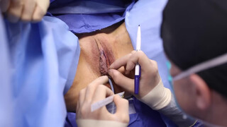 1. Pussy Op- acceptable because it’s medical?