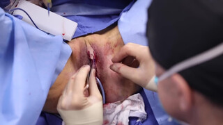 7. Pussy Op- acceptable because it’s medical?