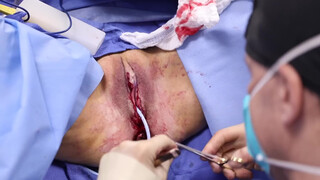 8. Pussy Op- acceptable because it’s medical?