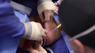 9. Pussy Op- acceptable because it’s medical?