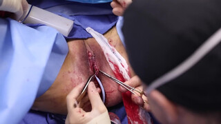 10. Pussy Op- acceptable because it’s medical?