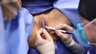 2. Pussy Op- acceptable because it’s medical?