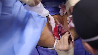 3. Pussy Op- acceptable because it’s medical?