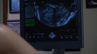 7. All about vaginal ultrasound – Dr. Gustavo