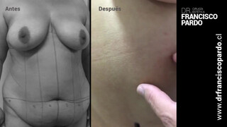 10. Love these surgery videos :)