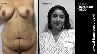 3. Love these surgery videos :)