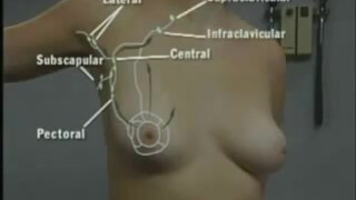 4. How to Give Breast Examination Russian Demonstration