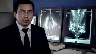 3. Especial cáncer de seno: Así es una mamografía