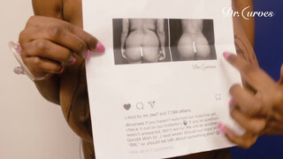 5. Woman Gets Breast Reduction to Improve Quality of Life