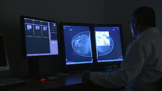 8. Czech mammogram and ultrasound